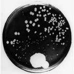 Photo historique de la boite de Pétri de Fleming montrant l’antagonisme entre des bactéries et une moisissure, le Penicillium . Visible au musée du St Mary’s Hospital à Londres