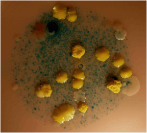 Des colonies de Staphylocoques dorés, entre autres, sur boite de Pétri.
